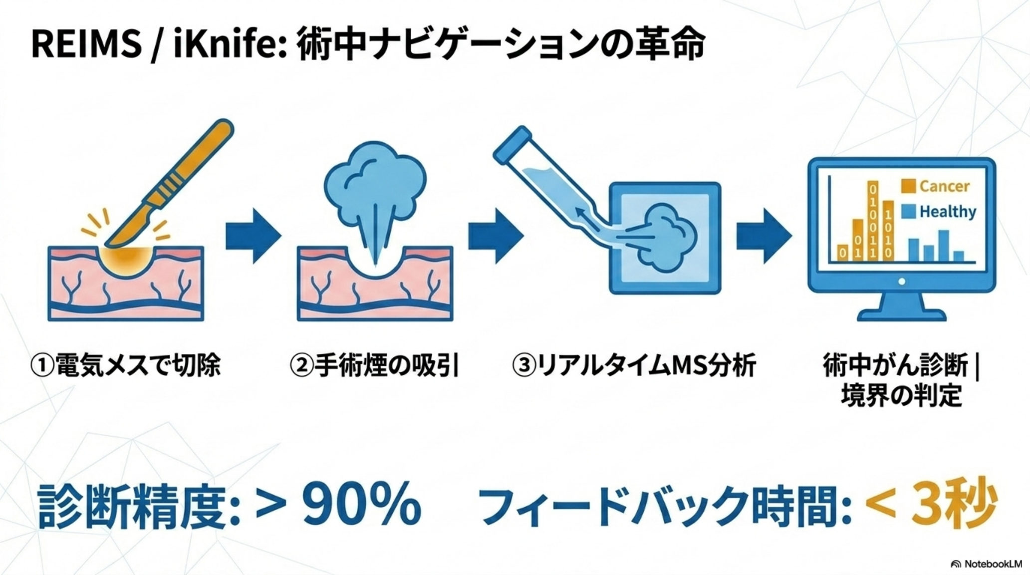 REIMS(iKnife)の原理と術中がん診断の精度データ図解